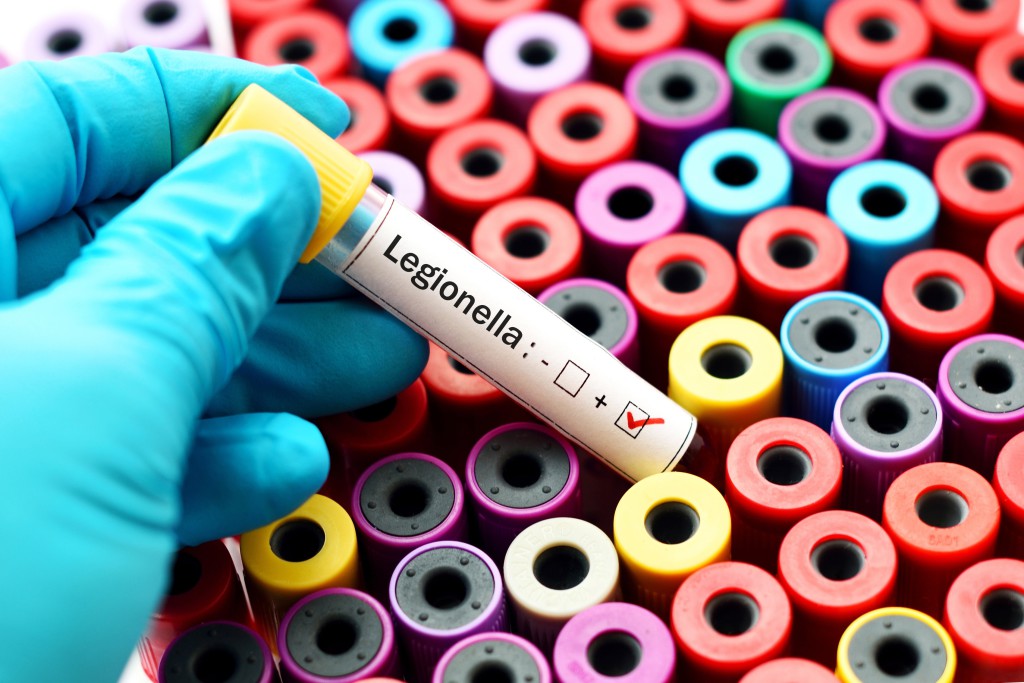Legionella testing